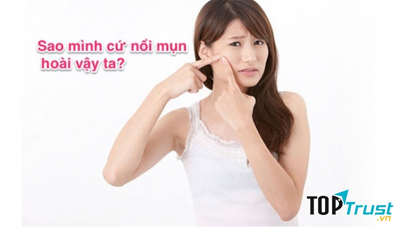 Bí quyết trị mụn tại nhà hiệu quả nhất