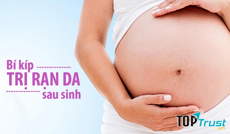 Bí quyết xóa rạn da khi mang thai bằng chanh