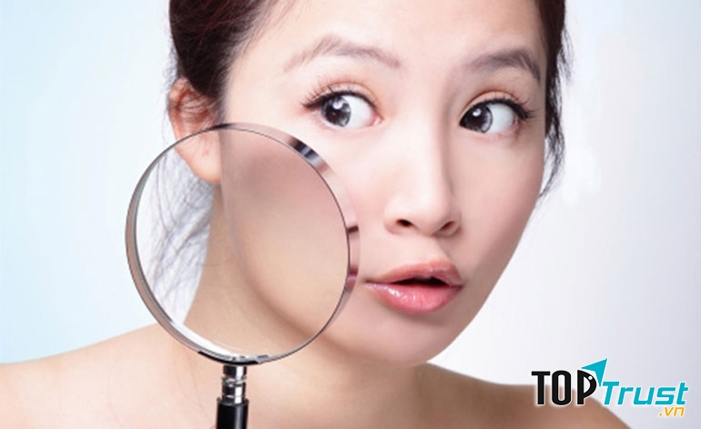 Bí quyết xóa sẹo thâm hữu ích nhất