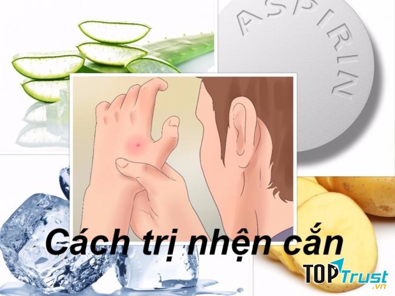 Biện pháp khắc phục khi bị nhện cắn tại nhà mà bạn nên biết