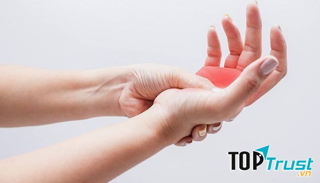 Cách chữa bệnh phong thấp theo dân gian