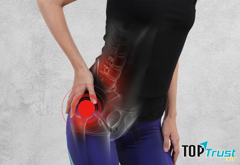 Cách chữa đau thần kinh tọa bằng cây thuốc quanh nhà