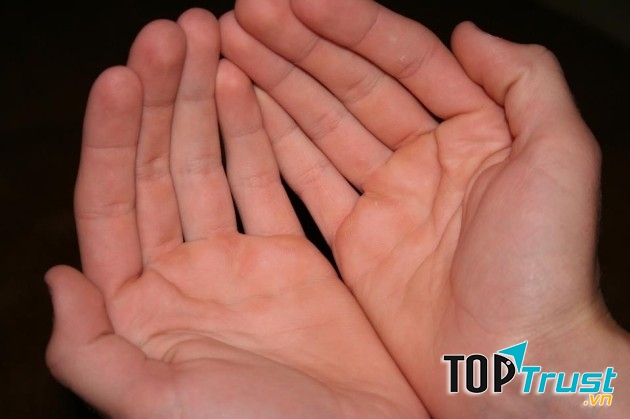 Cách chữa mồ hôi tay hiệu quả nhất