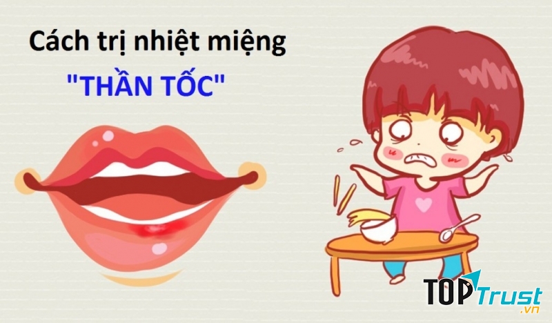 Cách chữa nhiệt miệng hiệu quả nhất hiện nay.