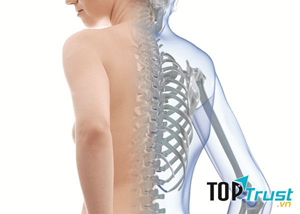 Cách phòng bệnh loãng xương hiệu quả