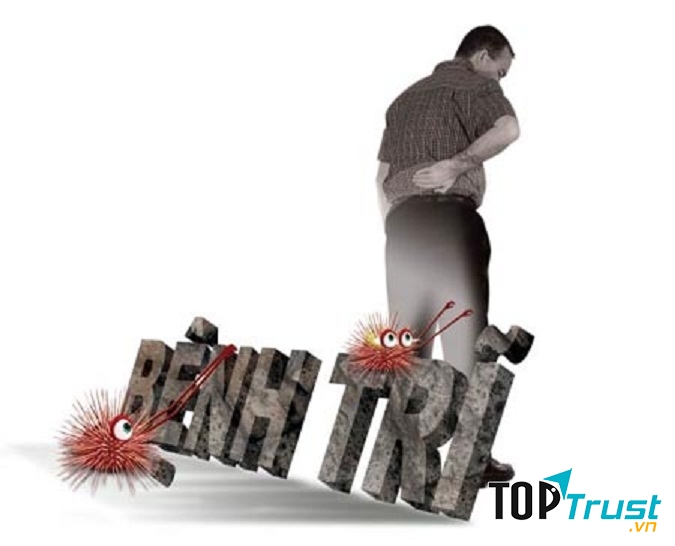 Cách phòng bệnh trĩ hiệu quả nhất