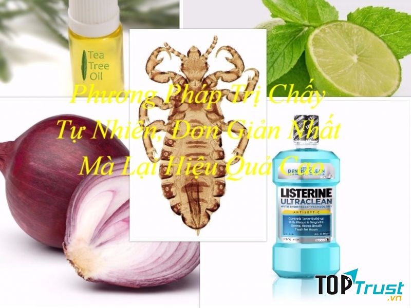 Cách trị chấy đơn giản mà hiệu quả nhất tại nhà