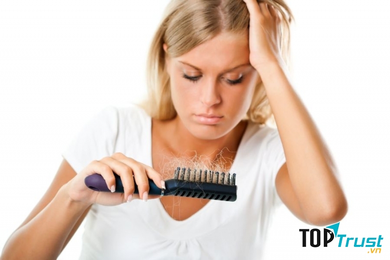 Cách trị hói đầu cực hiệu quả tại nhà