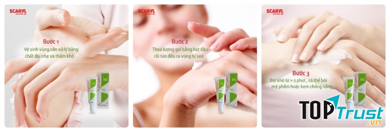 Cách trị sẹo thâm hiệu quả nhất hiện nay