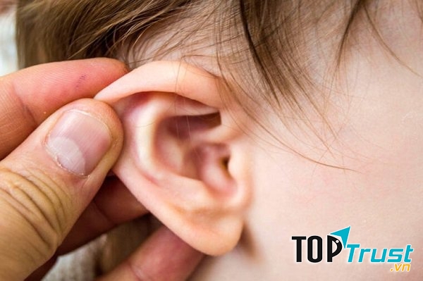 Cách trị viêm tai giữa hiệu quả nhất có thể áp dụng tại nhà