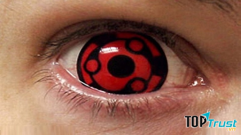 Căn bệnh kì lạ nhất trên thế giới