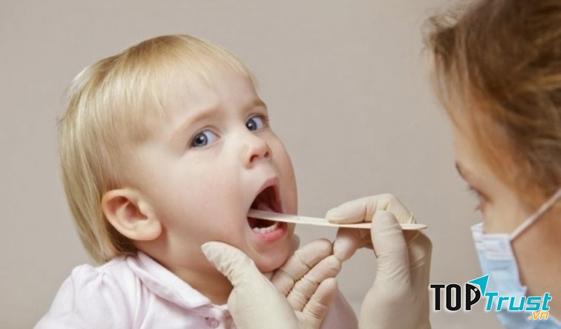 Căn bệnh thường gặp nhất ở trẻ em mà các bà mẹ cần lưu ý