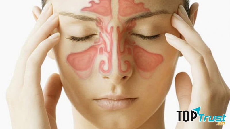 Cây cỏ vườn nhà, thần dược với bệnh viêm xoang