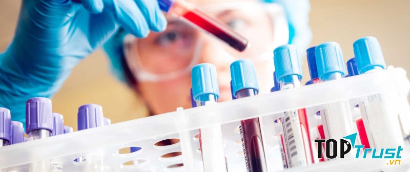 Cơ sở lấy mẫu xét nghiệm tại nhà uy tín nhất tại Tp HCM