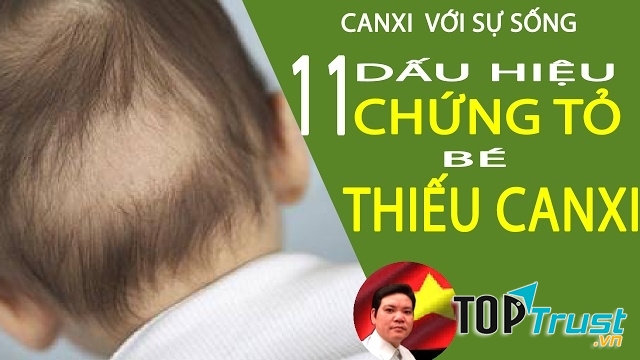 Dấu hiệu cho thấy trẻ thiếu canxi cha mẹ nên biết