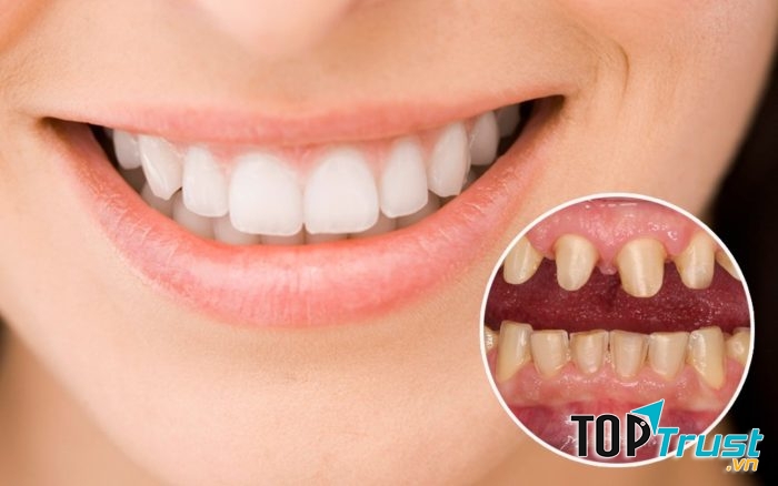 Địa chỉ bọc răng sứ thẩm mỹ tốt nhất tại quận Hoàn Kiếm, Hà Nội