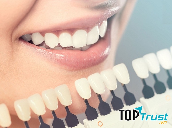 Địa chỉ bọc răng sứ thẩm mỹ tốt nhất tại quận Thanh Xuân, Hà Nội