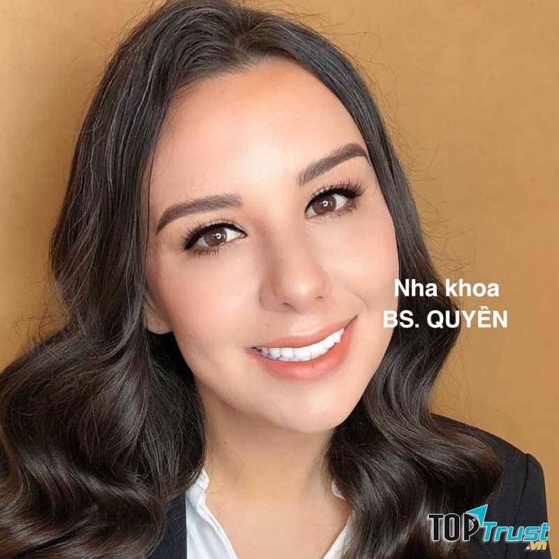 Địa chỉ bọc răng sứ uy tín nhất TP Rạch Giá, Kiên Giang