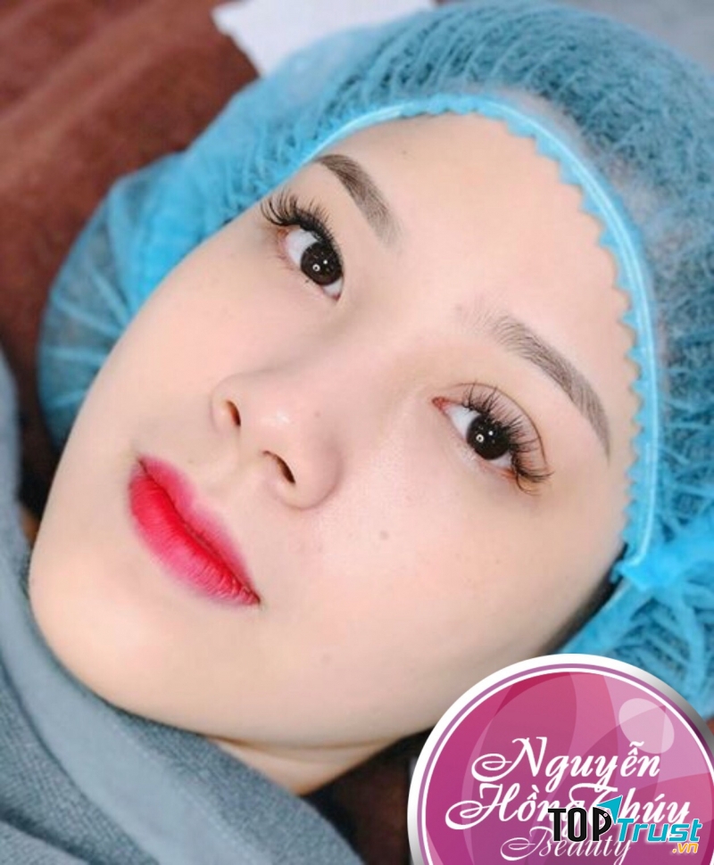 Địa chỉ cắt mí đẹp và an toàn nhất Gia Lai