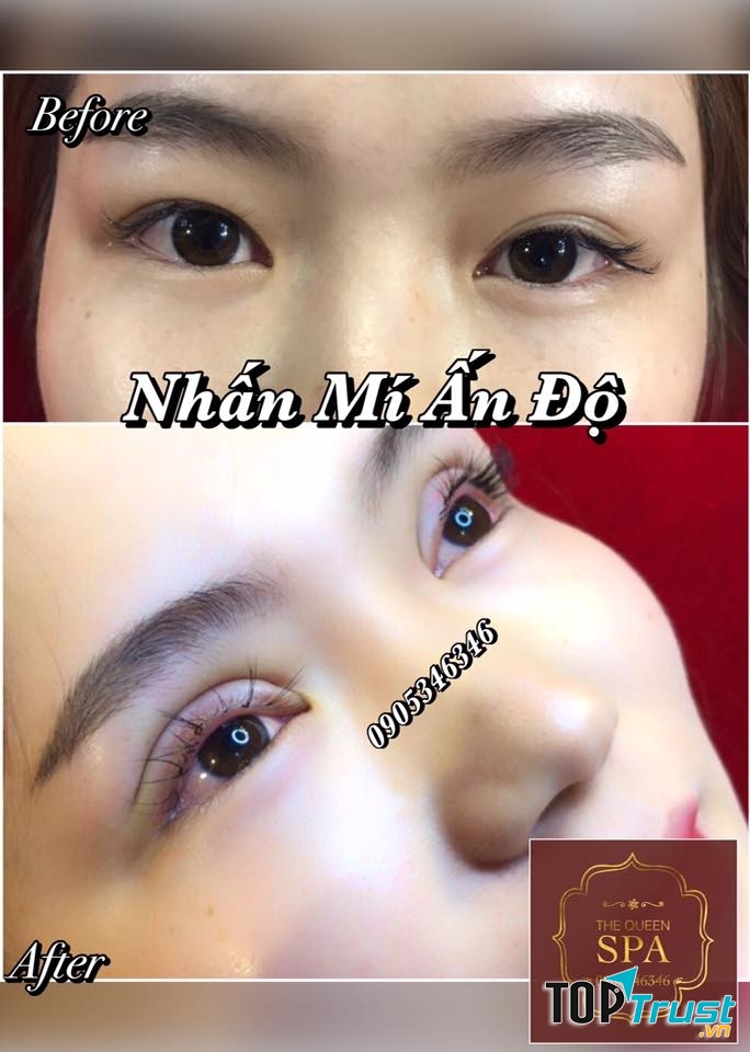 Địa chỉ cắt mí, nhấn mí đẹp và an toàn nhất TP. Buôn Ma Thuột