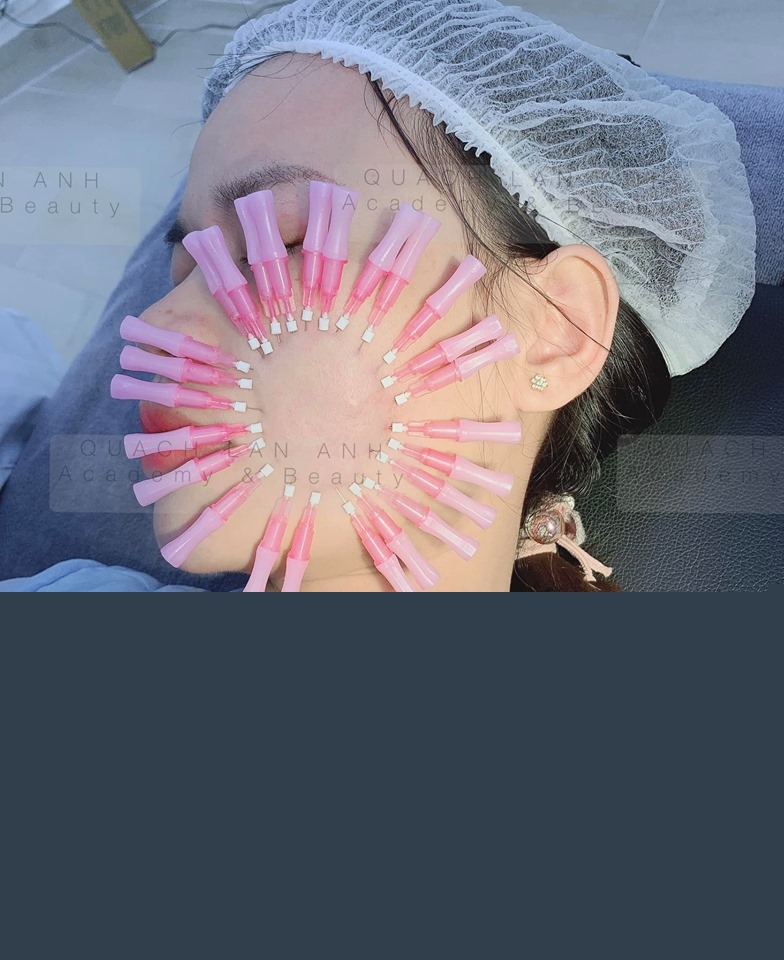 Địa chỉ dạy căng da bằng chỉ uy tín và chất lượng nhất Hà Nội