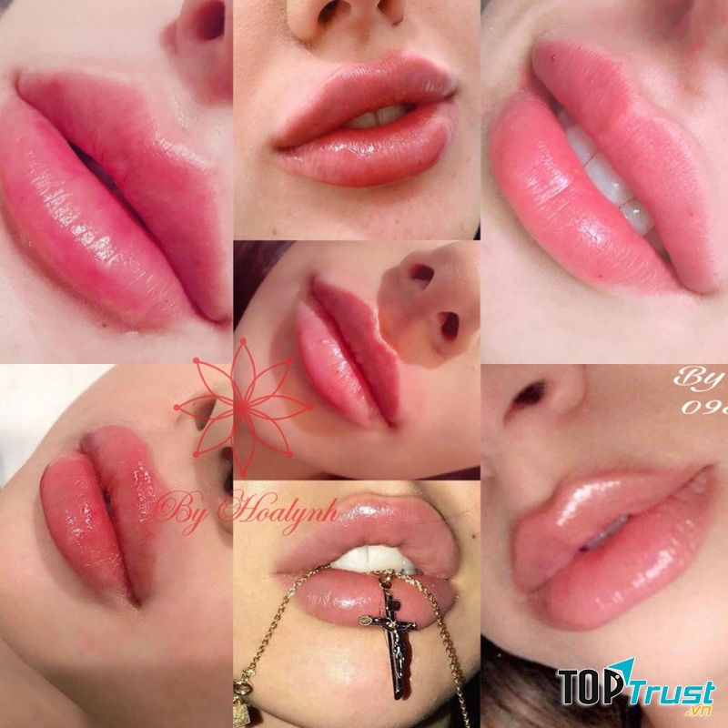 Địa chỉ dạy tiêm filler - botox uy tín và chất lượng nhất Hà Nội