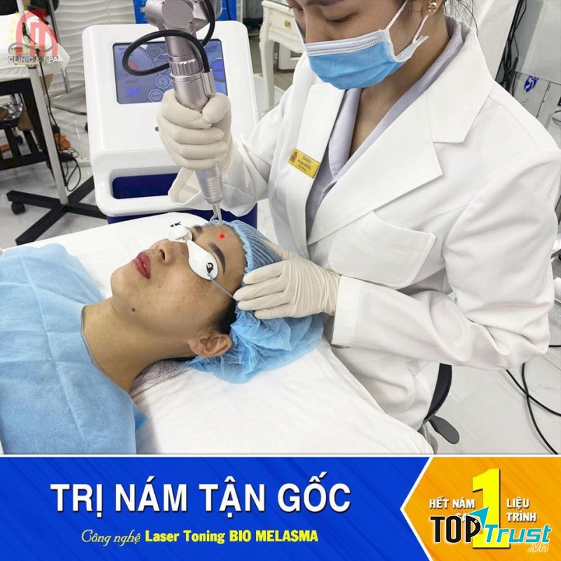 địa chỉ điều trị nám tốt nhất tại Pleiku, Gia Lai