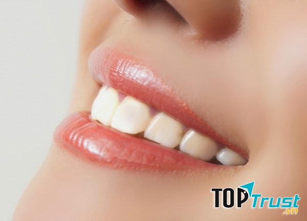 địa chỉ điều trị viêm nha chu uy tín hàng đầu tại Hà Nội