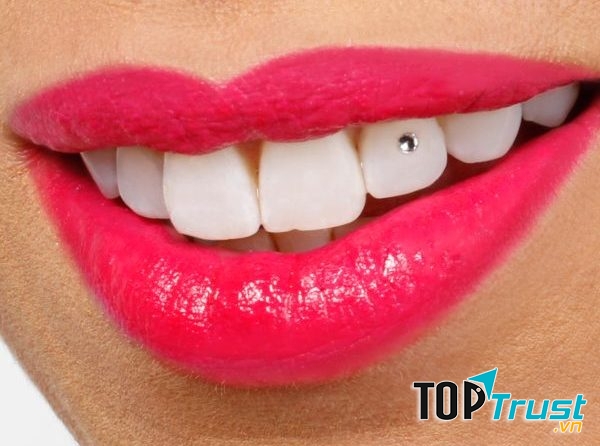 địa chỉ đính đá lên răng đẹp và an toàn nhất tại Hà Nội