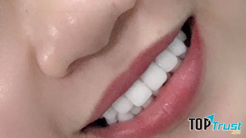 địa chỉ nha khoa thẩm mỹ được lựa chọn nhiều nhất