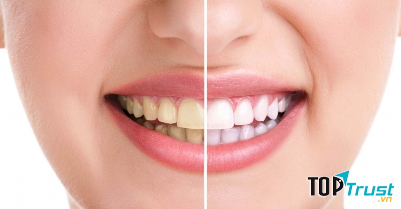 địa chỉ nha khoa tốt nhất tại Quận 9, TP.HCM