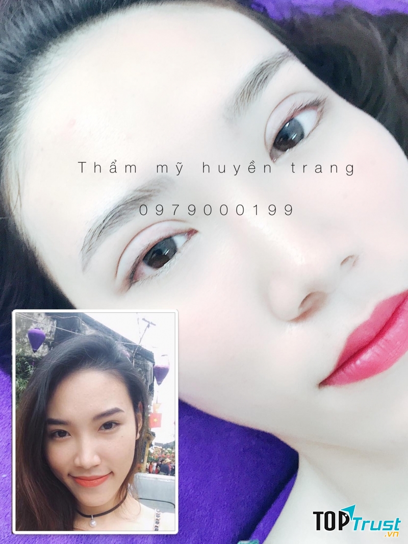 Địa chỉ nhấn mí, cắt mí đẹp và an toàn nhất Lạng Sơn