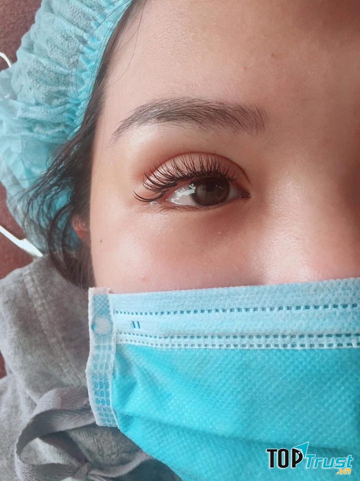 Địa chỉ nhấn mí, cắt mí đẹp và an toàn nhất Nha Trang