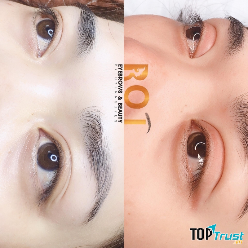 Địa chỉ nhấn mí đẹp và an toàn nhất Bà Rịa - Vũng Tàu