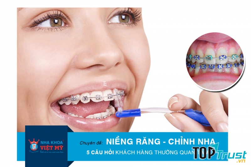 Địa chỉ niềng răng uy tín nhất quận 7, TP. HCM