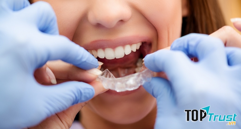 Địa chỉ niềng răng uy tín nhất quận Tây Hồ, Hà Nội