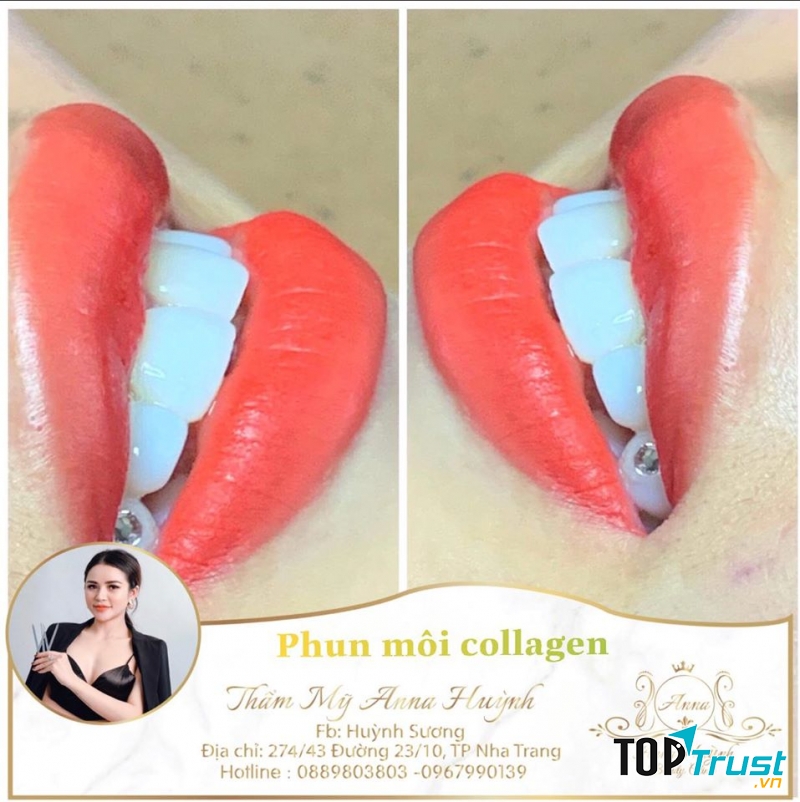 Địa chỉ phun xăm thẩm mỹ đẹp nhất Nha Trang