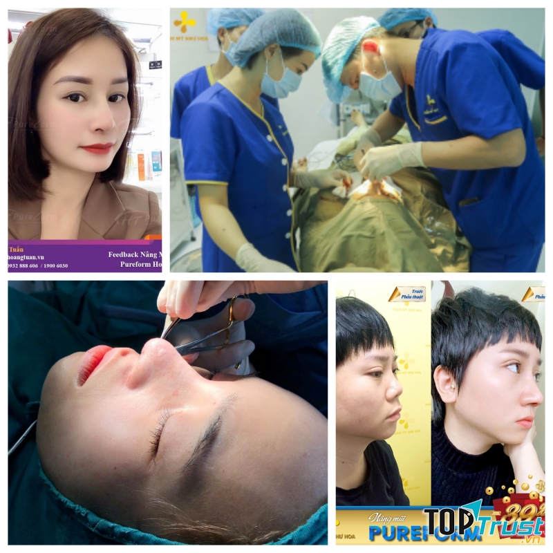 Địa chỉ sửa mũi hỏng uy tín nhất tại Hà Nội