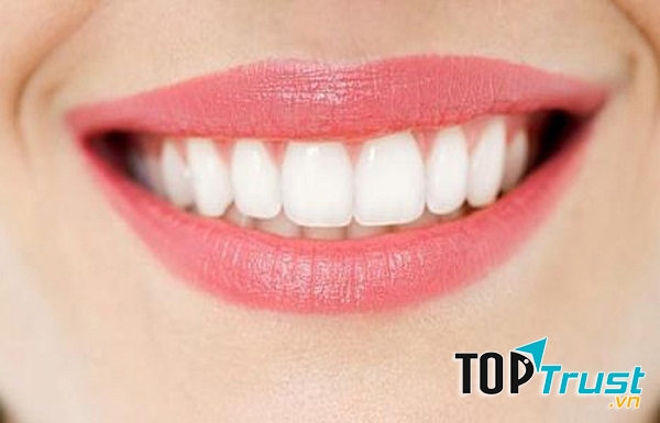địa chỉ tẩy trắng răng uy tín hàng đầu tại Hà Nội
