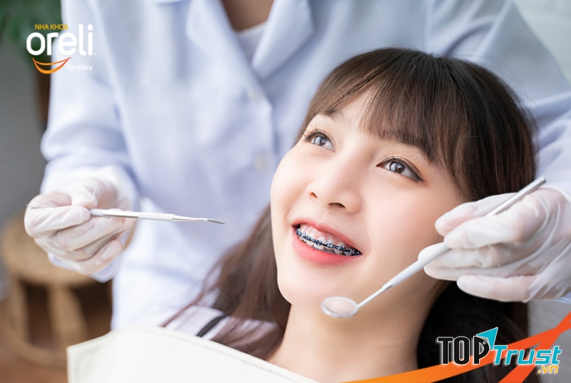 Địa chỉ tẩy trắng răng uy tín nhất TP. Buôn Ma Thuột