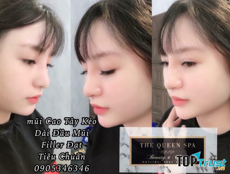 Địa chỉ tiêm filler - botox uy tín và chất lượng nhất TP. Buôn Ma Thuột