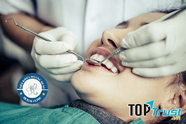 Địa chỉ trám răng uy tín nhất Bắc Ninh