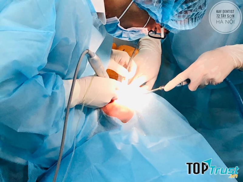 địa chỉ trồng răng implant uy tín nhất quận Đống Đa, Hà Nội