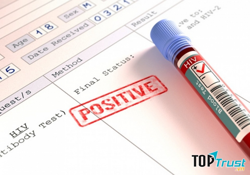 địa chỉ xét nghiệm HIV miễn phí đảm bảo nhất ở Sài Gòn