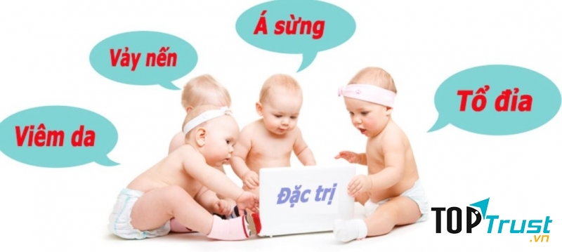 Điều cần biết về bệnh viêm da cơ địa