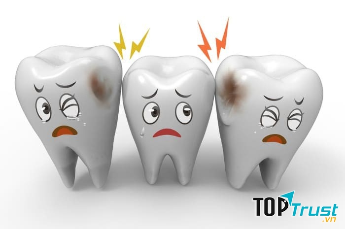 Kem đánh răng đặc trị ngừa sâu răng hiệu quả nhất hiện nay