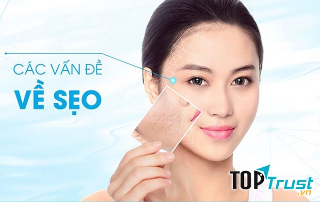 Kem trị sẹo bỏng lâu năm tốt nhất hiện nay