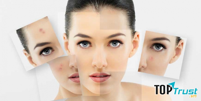 Kem trị sẹo của Đức tốt nhất hiện nay