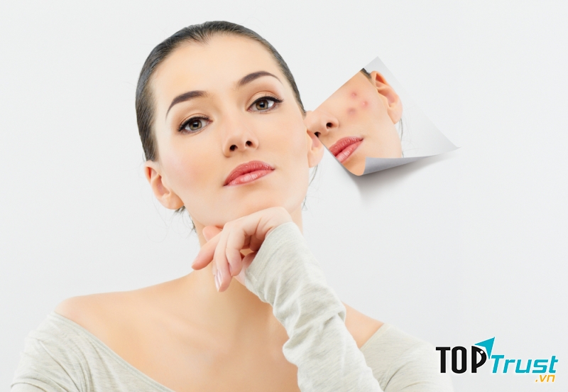 Kem trị sẹo Đông y tốt nhất hiện nay