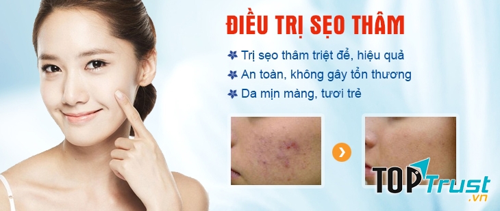 Kem trị sẹo Nga tốt nhất hiện nay.